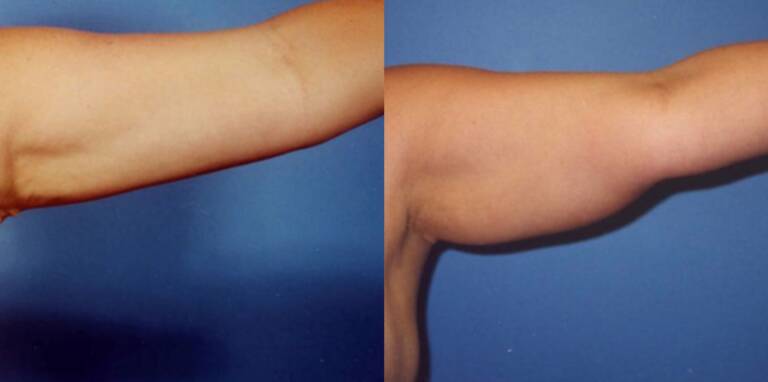 6D6BA657-6200-4BEE-9E7E-CA1920A07DBE