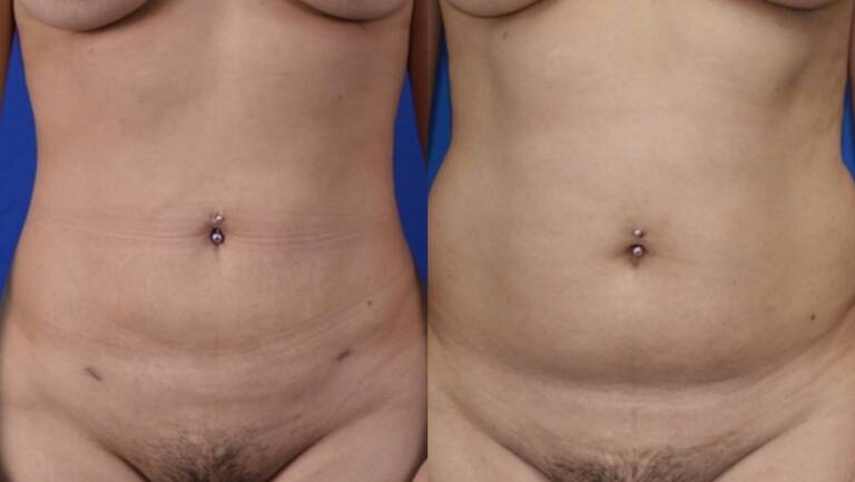 79619540-551D-4411-A814-FE137C28F8CE