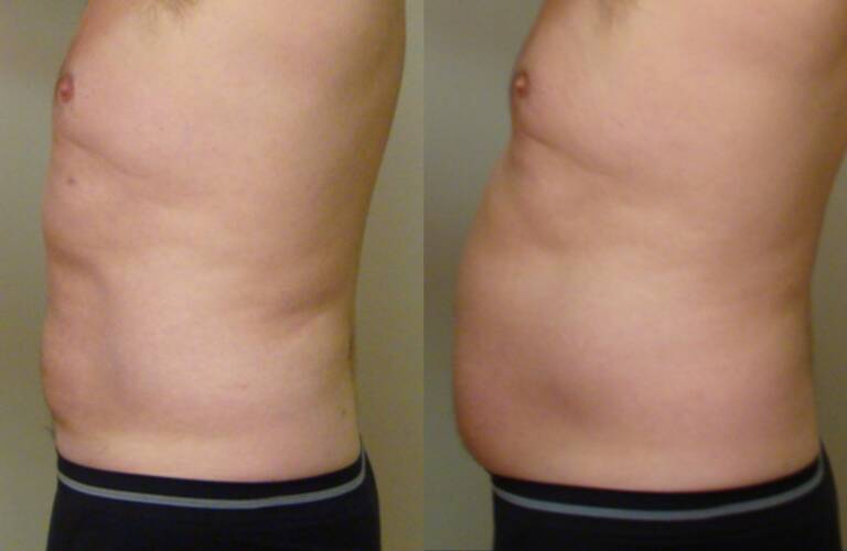 88BA498A-577E-4A75-99DD-BB70E1CE43F4