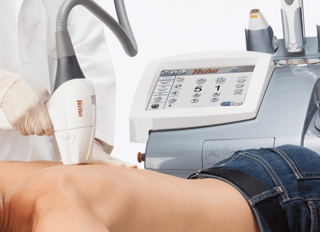 depilacja laserowa vectus