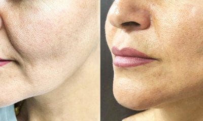 nucleofil biostymulator