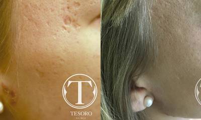 przedpo2-n6iwoq6hizoykegjyrwqt4idah7hdbipsp2n923bcc