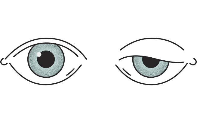 ptoza wrocław zabieg