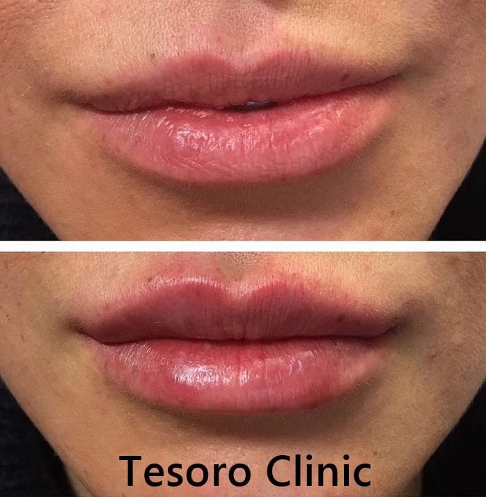 tesoro clinic