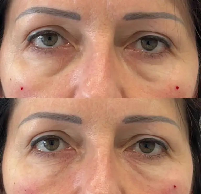 wypełnianie-doliny-łez-wrocław