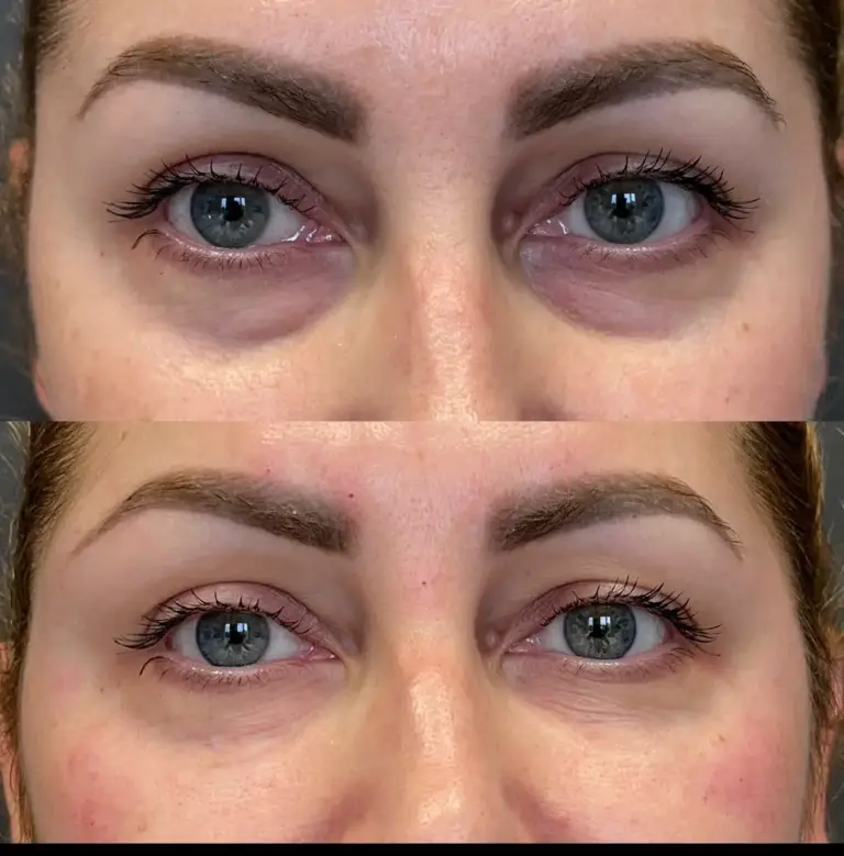 wypełnianie-doliny-łez-wrocław-tesoro