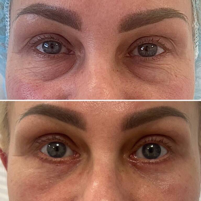 C91FA45F-0568-489D-8E24-153785E902F1-1-1024x1024